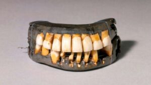 El diente que nunca se cambia: un misterio dental revelado
